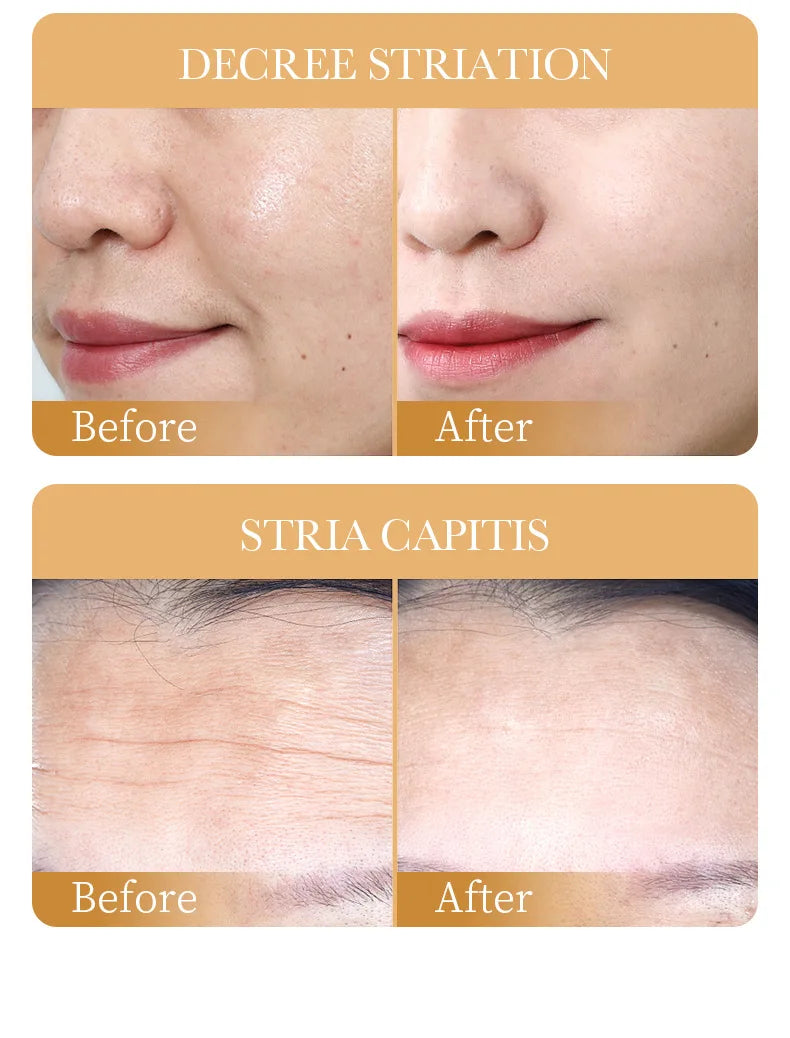 Collagen Face Mask Moisturizing Anti-aging